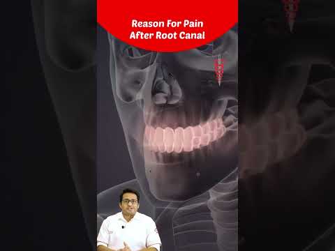 Top Reason For Pain After Root Canal Treatment? Dental Insights by Dr Chirag Chamria | Royal Dental